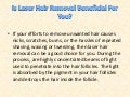 Is laser hair removal beneficial for you?
