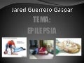 Epilepsia