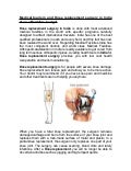 Medical tourism and Knee replacement surgery in India at an affordable budget