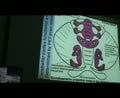 L6 Cerebellum Part 2 