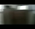 L6 Cerebellum Part 3