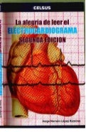 LA ALEGRIA DE LEER EL ELECTROCARDIOGRAMA