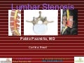 Lubar Arthritis : Lumbar Stenosis by Pablo Pazmino, MD