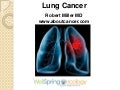 Lung Cancer Video1