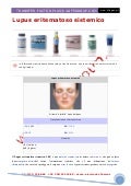 Lupus Eritematoso Sistemico