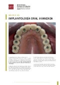 Master implantologia oral (UEM Valencia)