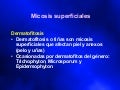 Micosis Superficiales