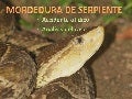 Mordedura de Serpiente