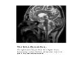 Mrcp Part 2 Witten Exam