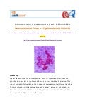 Aarkstore.com   Neuroendocrine tumors – pipeline review, h1 2012