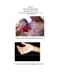 Initial Report on Increasing Incidence of Diarrhea Cases in Barangay Culamdanum, Bataraza March 31, 2011