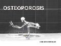 Osteoporosis sem