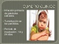 Parotiditis viral