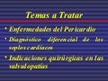 Pericardio.soplos.indicaciones quirúrgicas.2