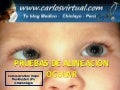 Pruebas De Alineacion Ocular