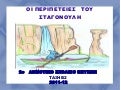 Οι περιπέτειες του Σταγονούλη