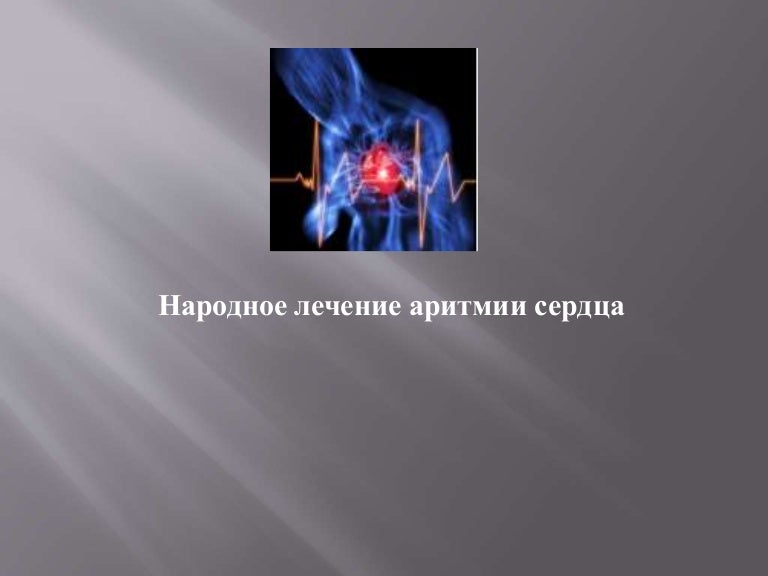 Фото Аритмии Сердца