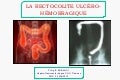 Recto colite ulcero-hemmoragique  fmc  Pr Arbaoui  CHU Tlemcen
