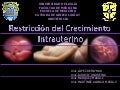 Restricción de crecimiento intrauterino
