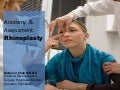 Rhinoplasty