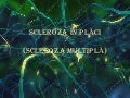 Scleroza