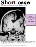 Short case...Septo-optic dysplasia