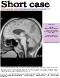 Short case...Aicardi syndrome