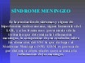Sìndrome meningeo y meningitis