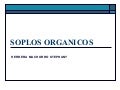 soplos