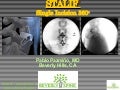 Lumbar Fusion : A New Anterior Only Option. The STALIF