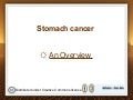Stomach Cancer