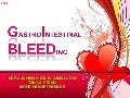 Gastrointestinal Bleeding