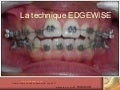 Technique Edgewise