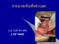 Thoracic Trauma (Thai)