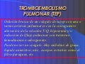 Tromboembolismo pulmonar