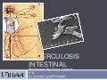 Tuberculosis intestinal 