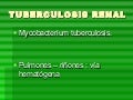 Tuberculosis Renal