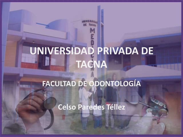 PROTESIS PARCIAL REMOVIBLE