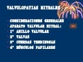 Valvulopatias mitrales 1