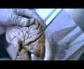 Ventricles3 4 - part1