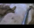 Ventricles3 4-diencephalon-brainstem part2