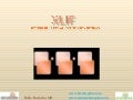 XLIF by Pablo Pazmino MD