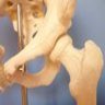 Hip Arthroscopy-Physiocure, profile picture