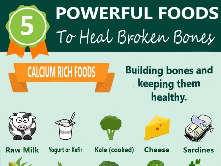 5 Powerful Food To Heal Broken Bones Full 5-powerful-food-to-heal-broken-bones-full