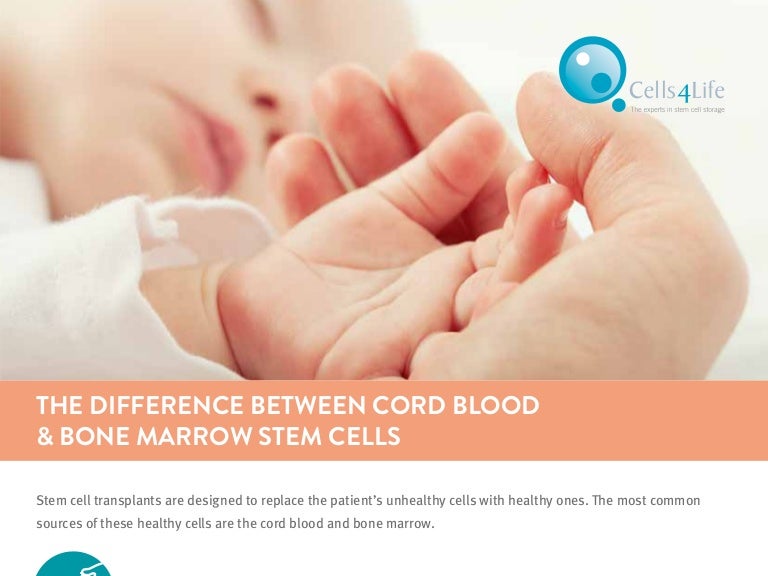 Cord bloodvsbonemarrowstemcellsinfographic