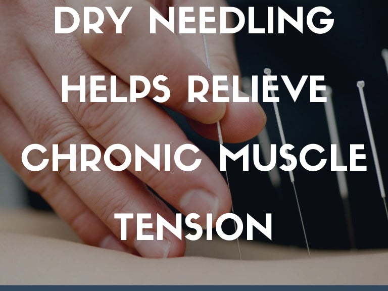 Dry needling helps relieve chronic muscle tension