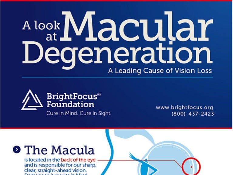 A Look At Macular Degeneration Infographic