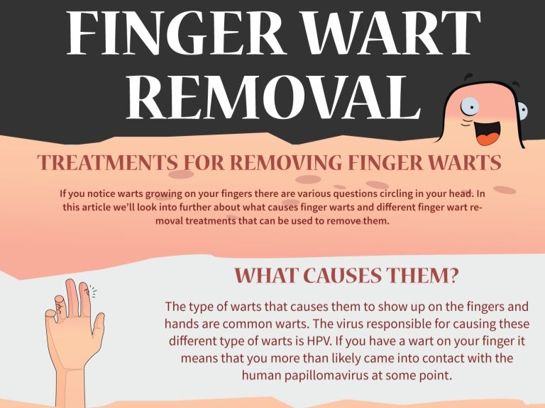 Finger wart removal