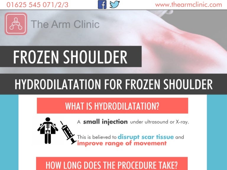 Hydrodilatation for Frozen Shoulder