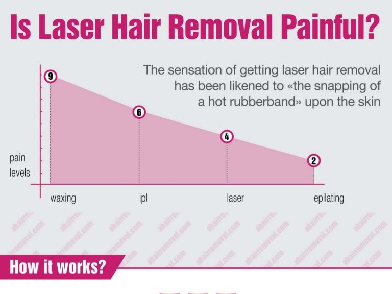 Laser Hair Removal Chart